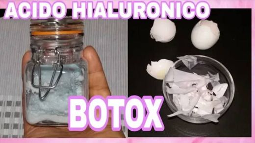 Botox sin Cirugía || Acido Hialuronico - YouTube