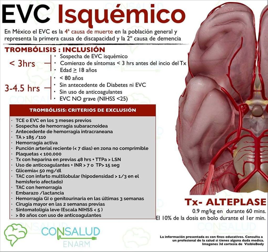 Moda ¿Qué es un EVC? Video educativo