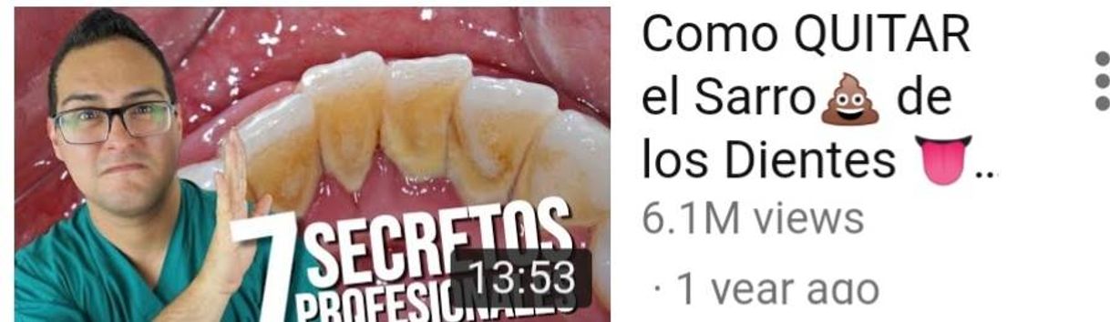 Fashion Como quitar el sarro de los dientes 