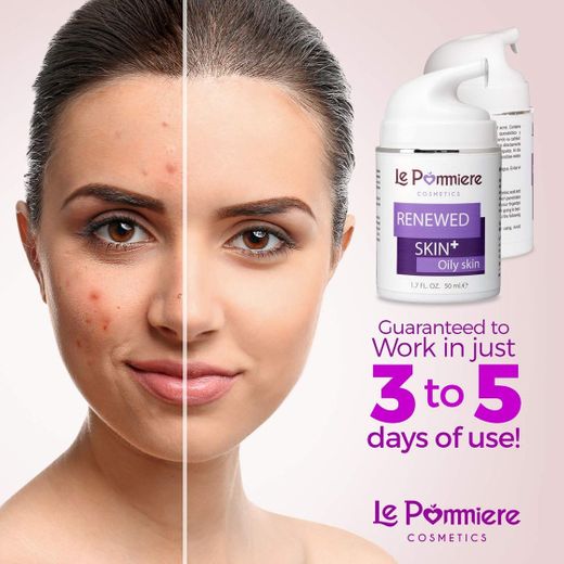 Le Pommiere Acné Gel 50ml, Ayuda a Remover Espinillas, Granos en Cara