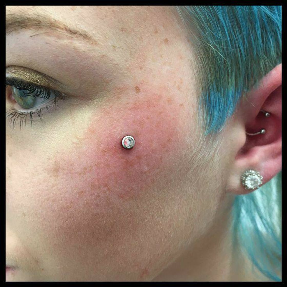 Fashion Microdermal 