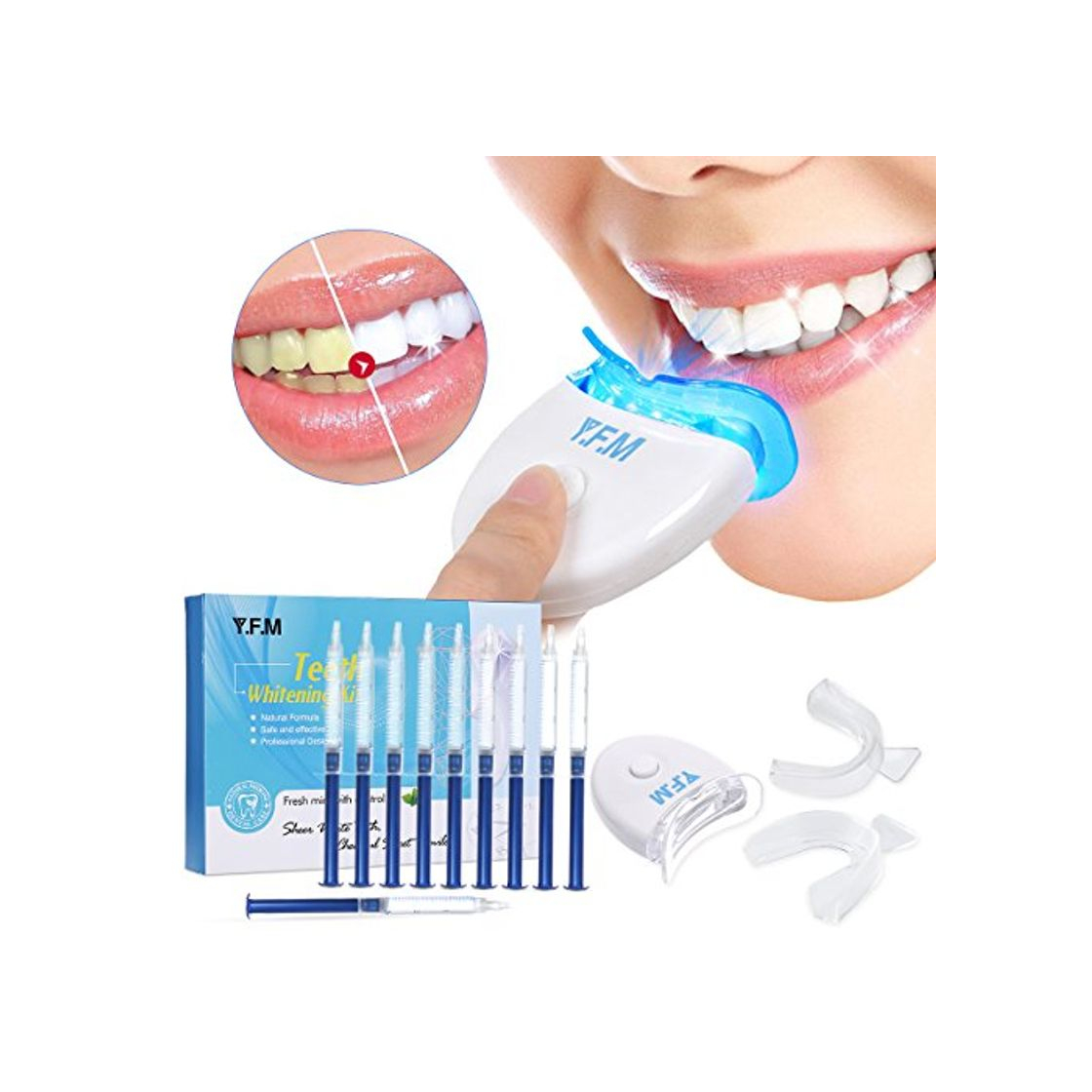 Social Y.F.M Kit de Blanqueamiento de Dientes Profesional en Casa Juego de Blanqueamiento
