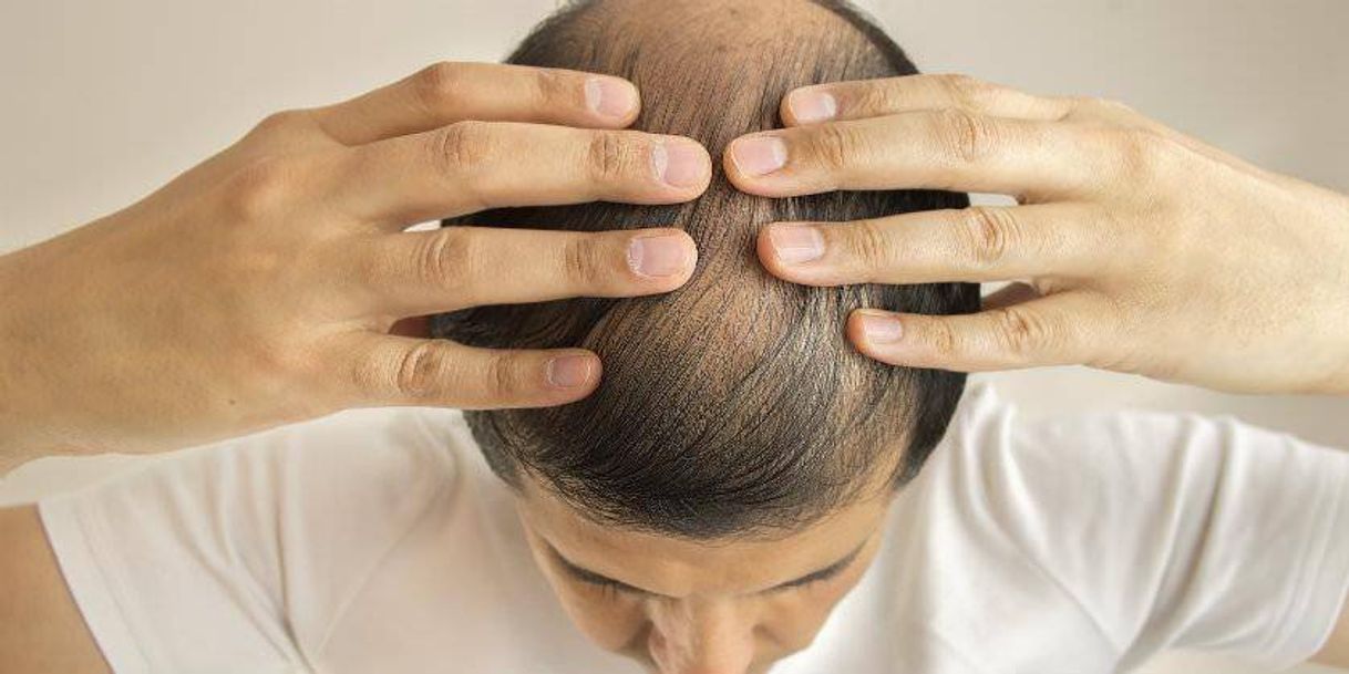 Social ¿Cómo Evitar La Caída Del Cabello? 7 Tips. - YouTube