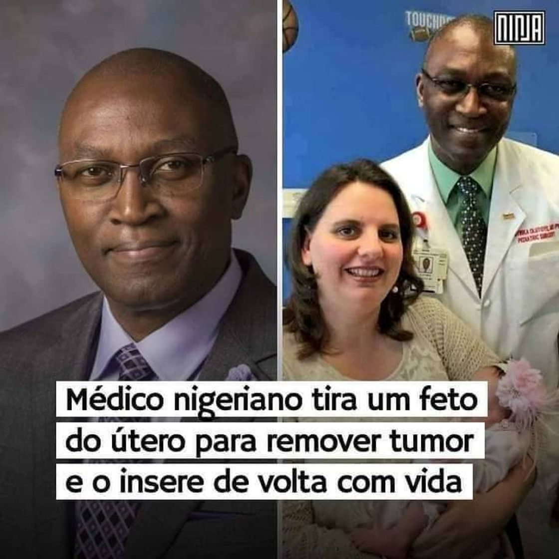 Fashion Médico Nigeriano faz operação inédita. 