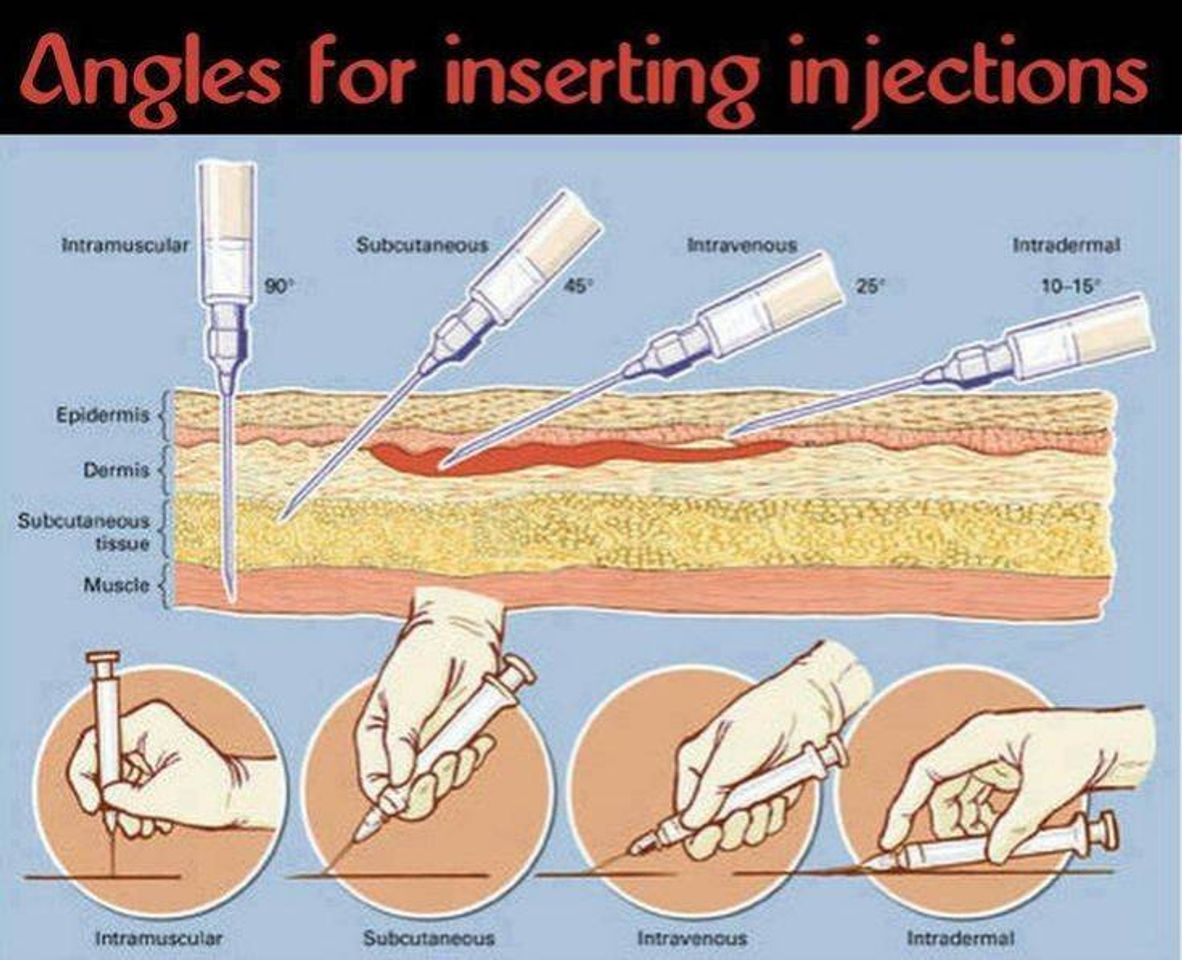 Moda Ângulos de inserção da agulha 💉