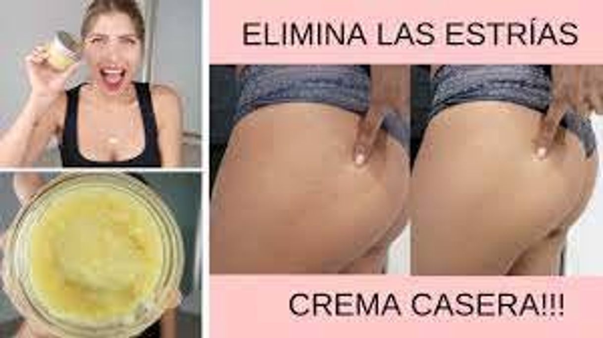 Fashion ELIMINA LAS ESTRÍAS EN UNA SEMANA CON ESTA CREMA ...