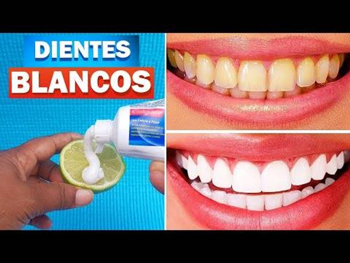 Fashion 3 Formas de BLANQUEAR los DIENTES de Forma Casera y Quitar ...