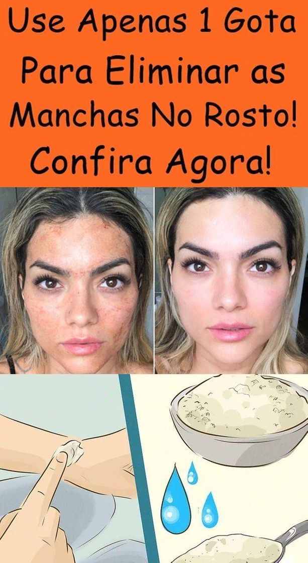 Social Usa esse método e as macha vai desaparecer