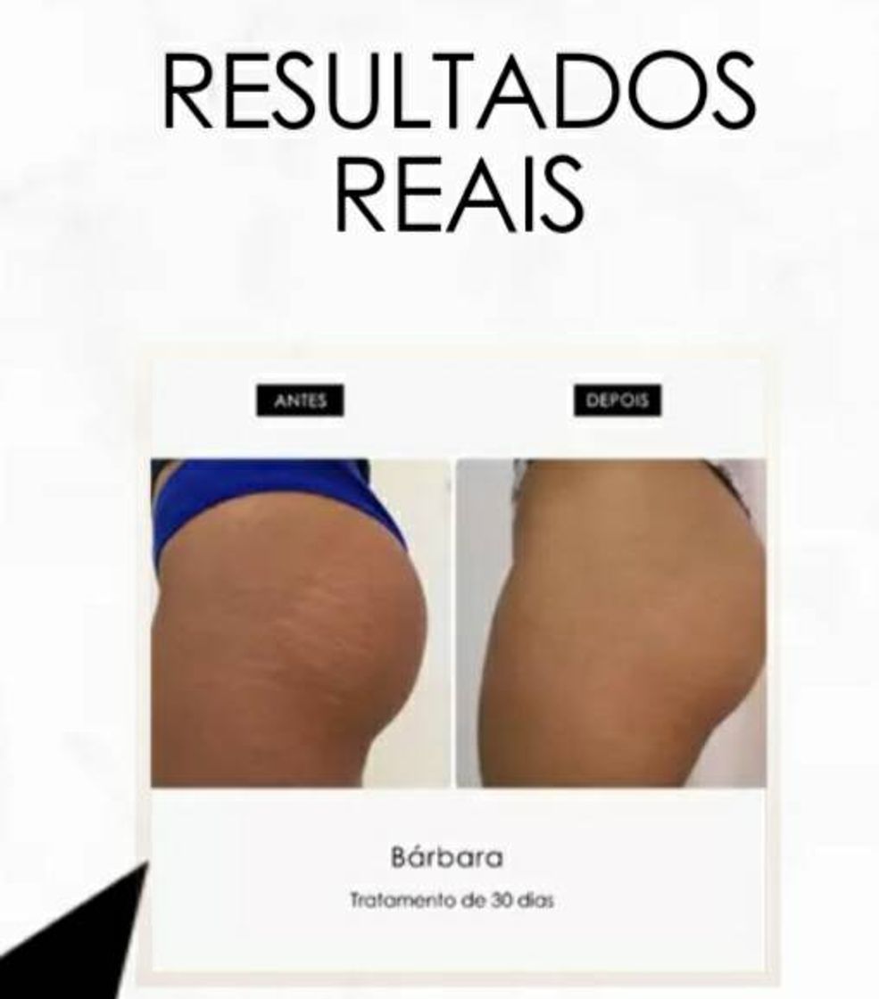 Social Silk skin colágeno contra estrias