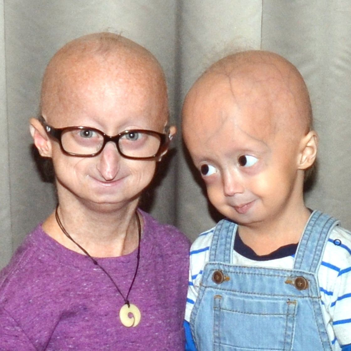 Fashion Progeria