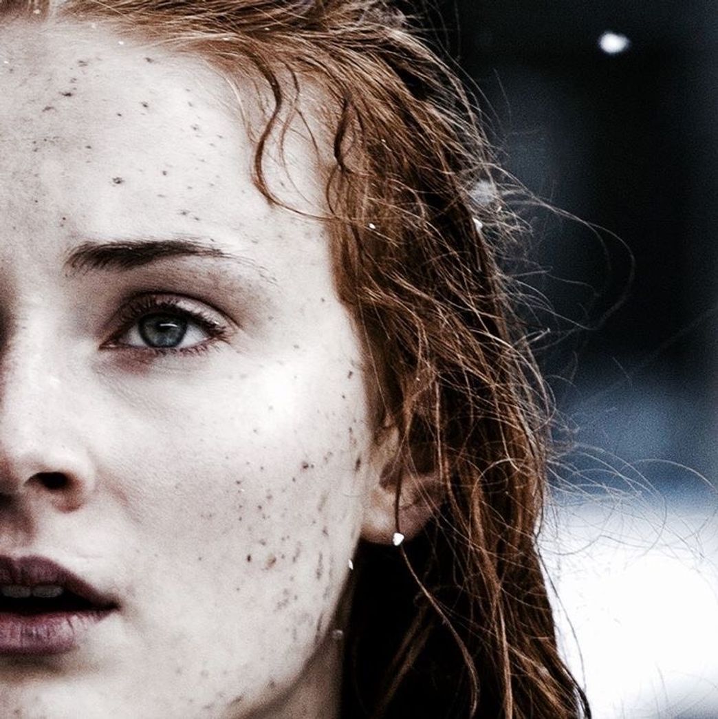 Sansa