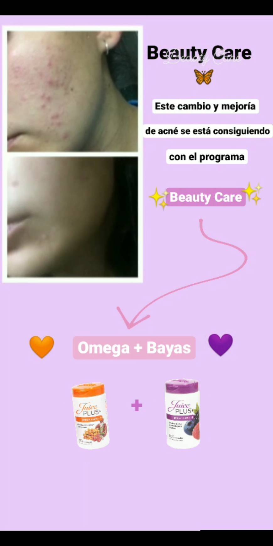 Beauty Care🦋