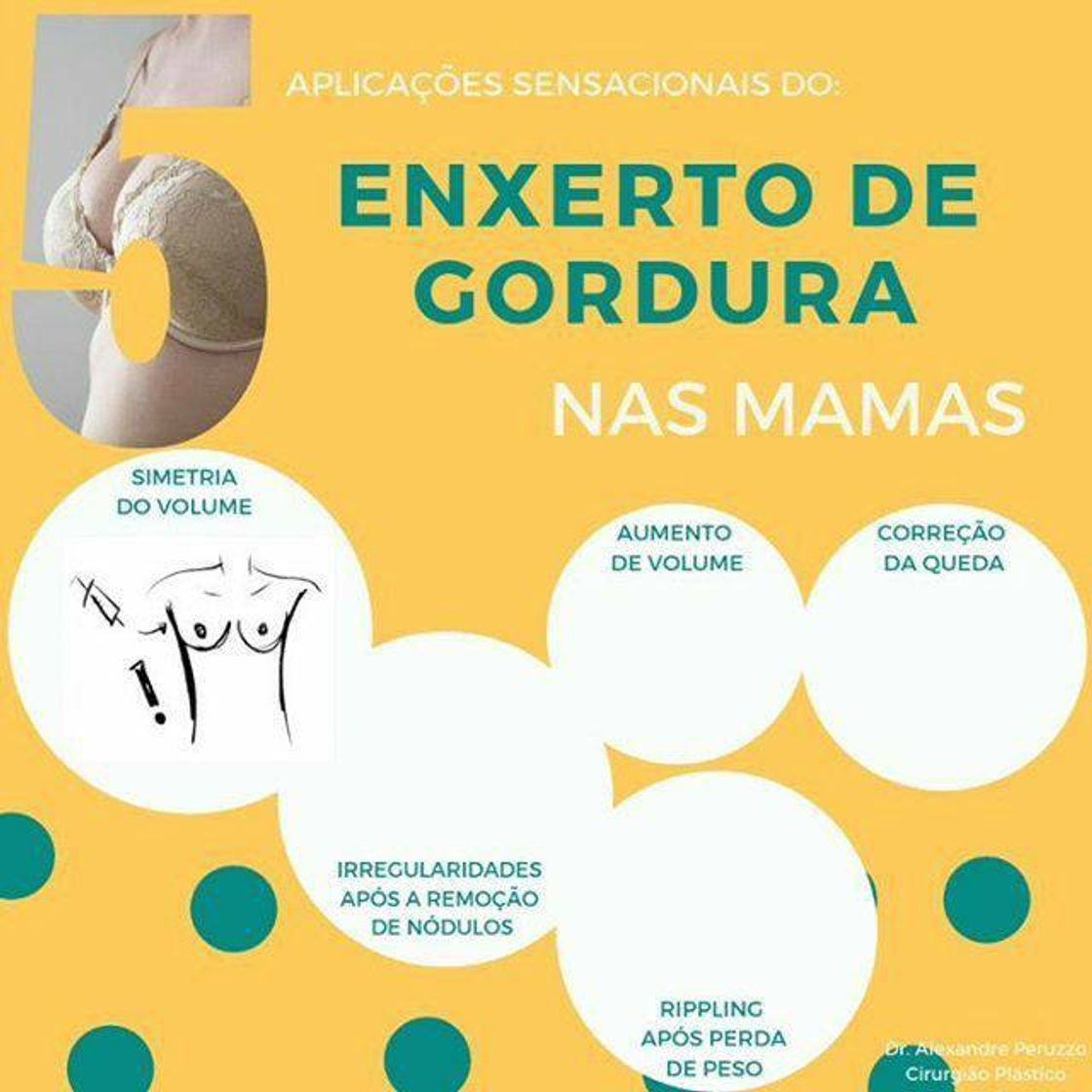 Social Exerto de gordura nas mamas