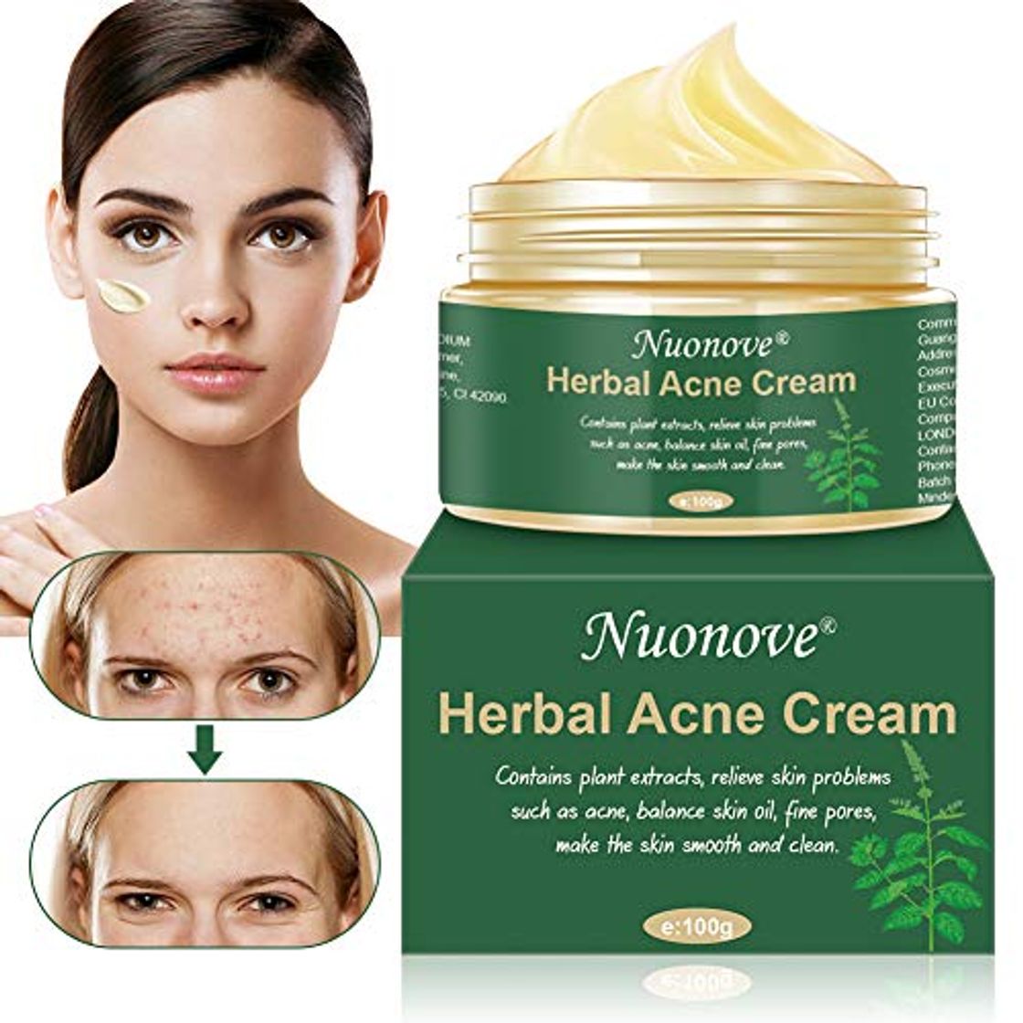 Producto Crema Antiacne