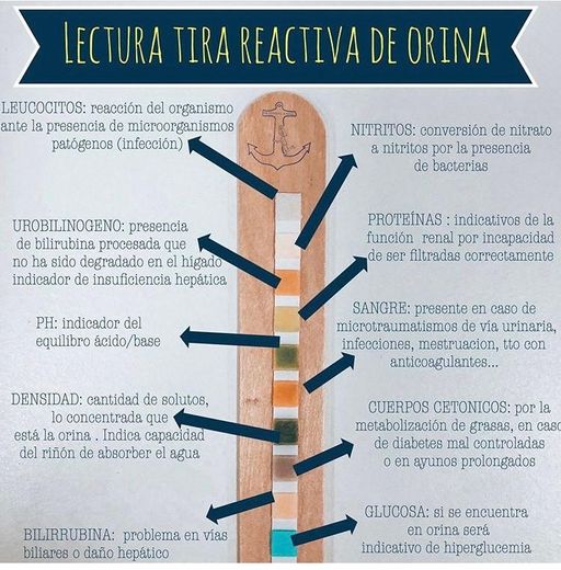 Lectura tira de orina