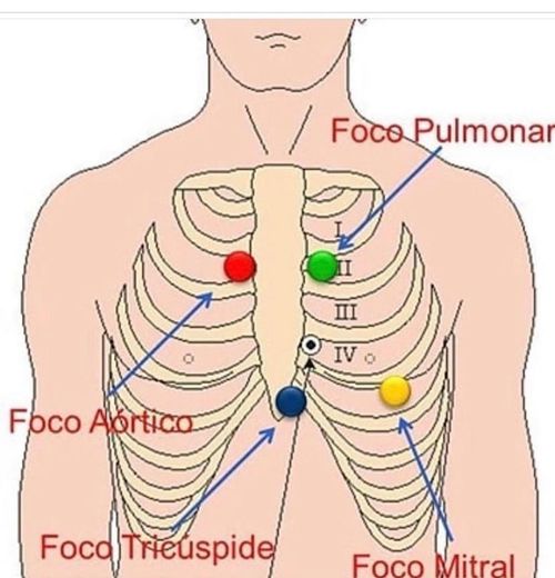 Focos auscultación 