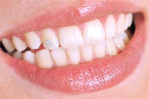 Piercing diente