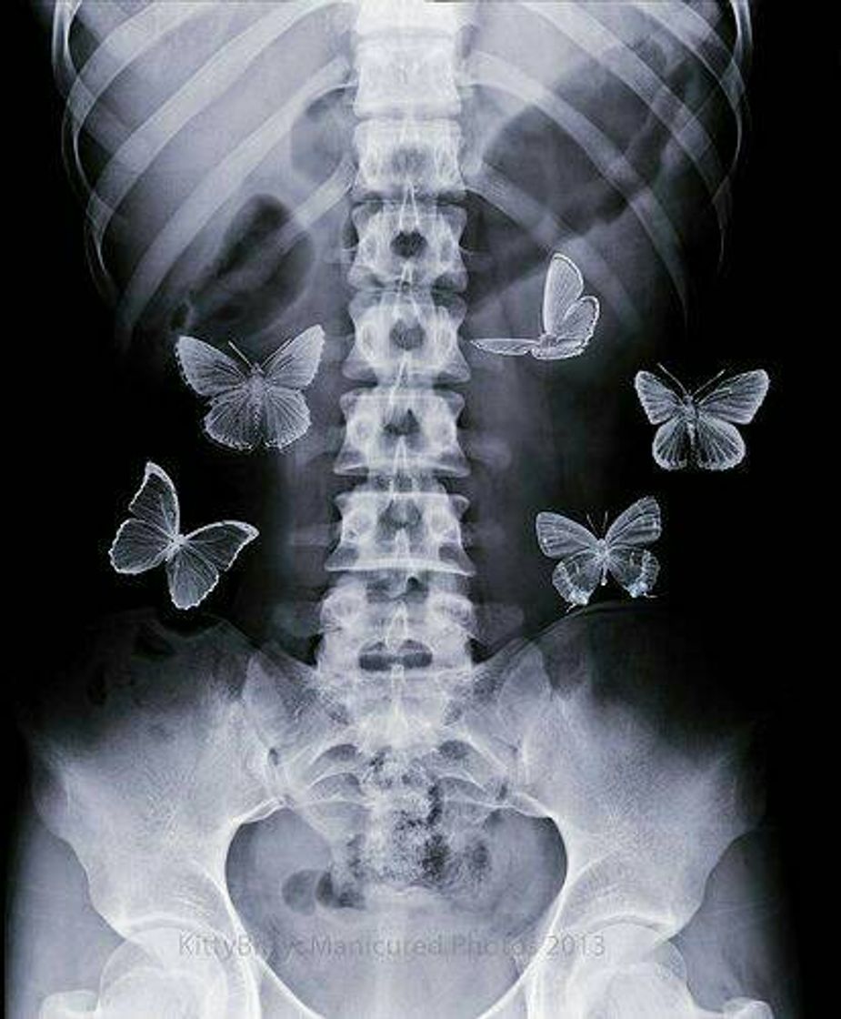 Moda Butterflies in the stomach