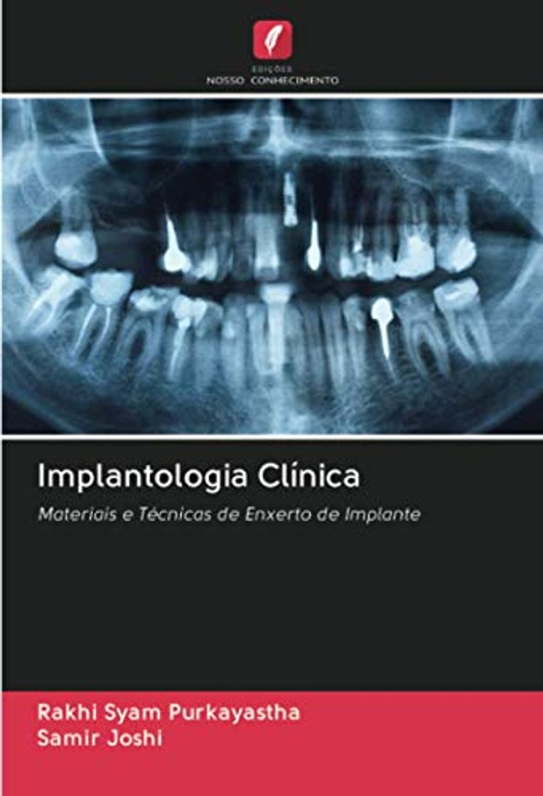 Books Implantologia Clínica: Materiais e Técnicas de Enxerto de Implante