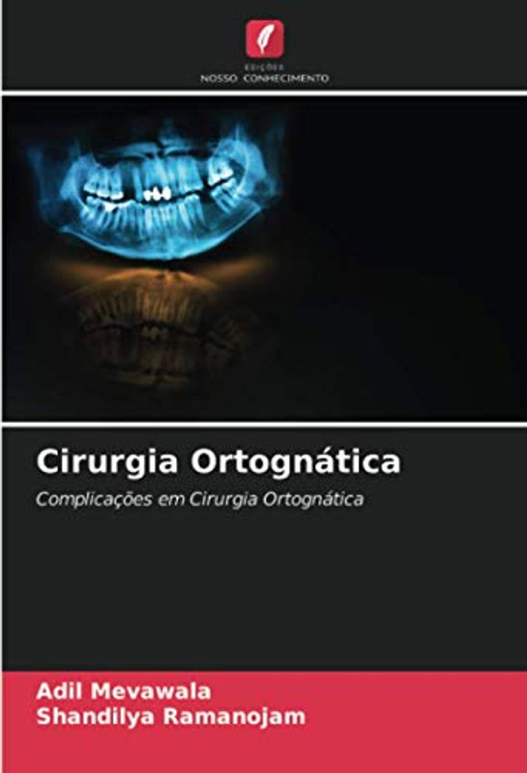 Books Cirurgia Ortognática: Complicações em Cirurgia Ortognática