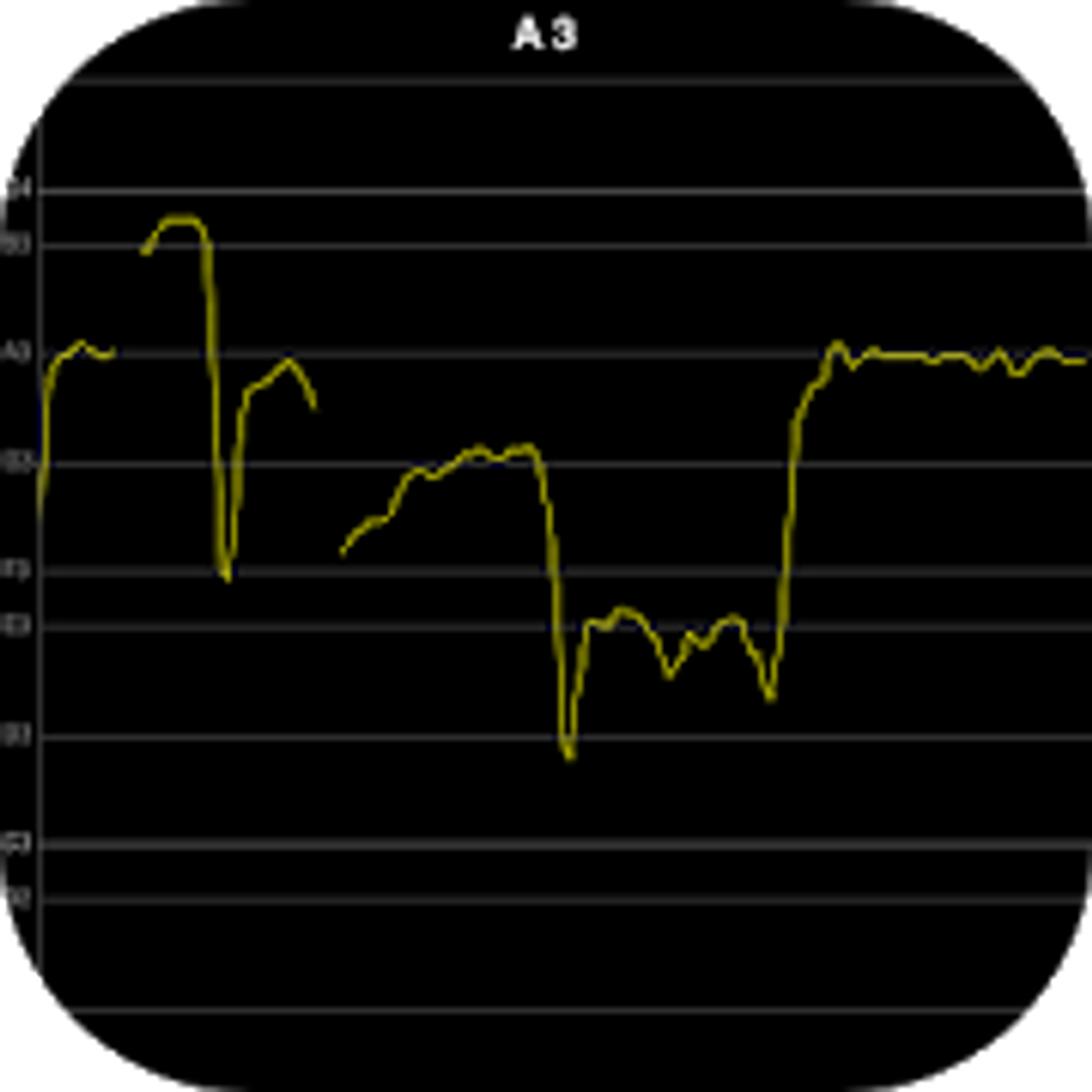 App Vocal Pitch Monitor