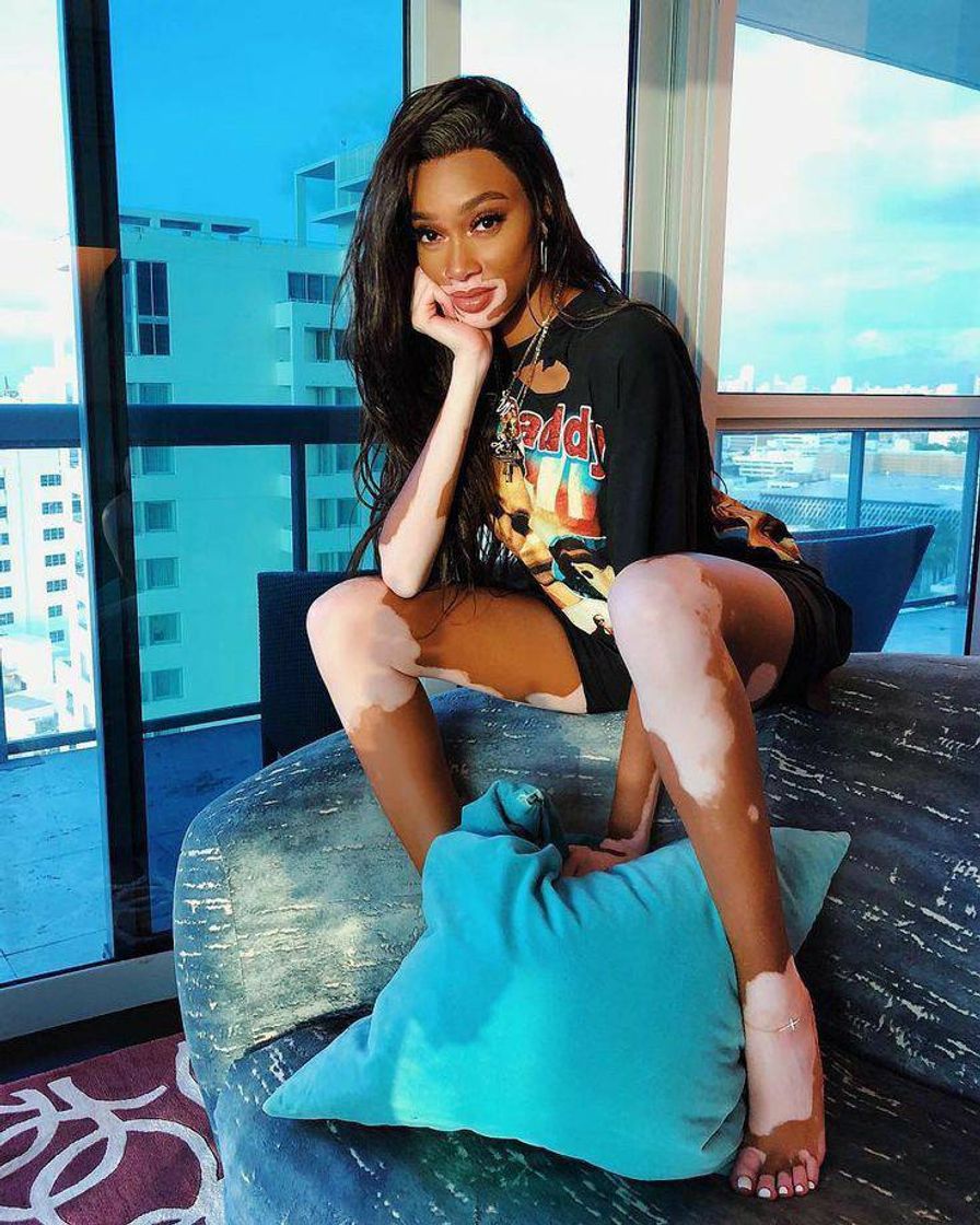 Fashion Winnie harlow