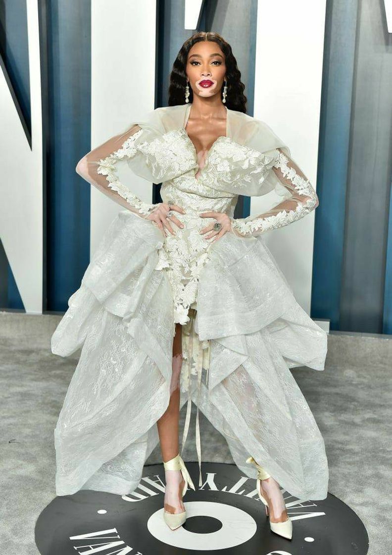 Moda Winnie harlow