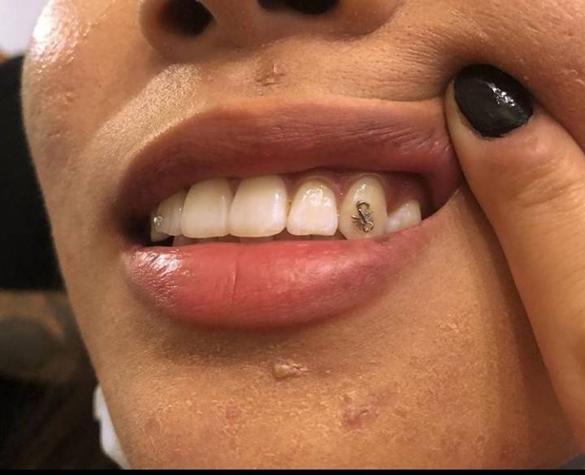 Moda Piercing no dente 