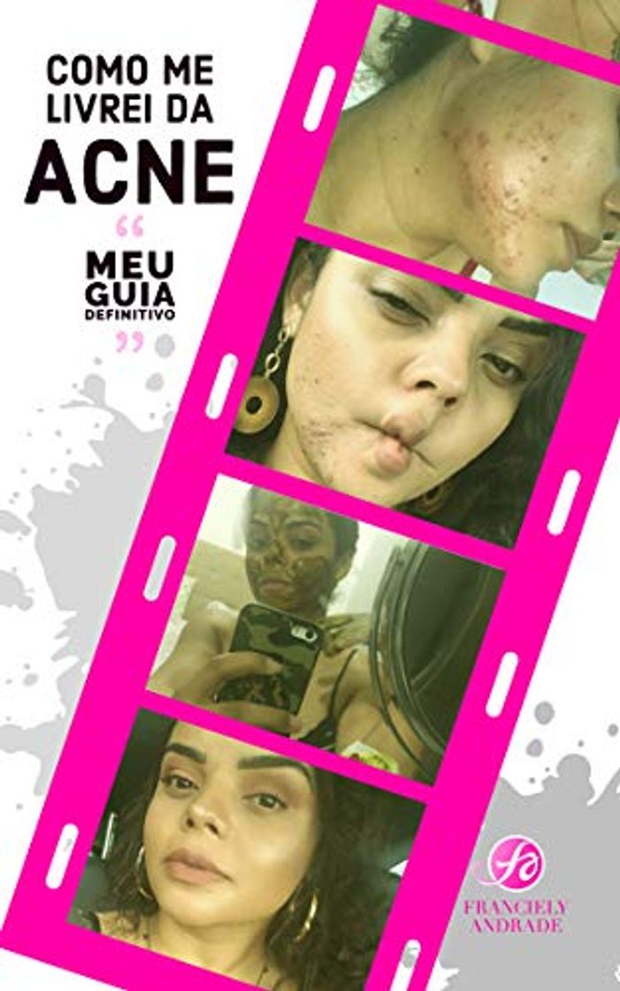 Products Como me livrei da ACNE - Meu guia definitivo: Como consegui controlar