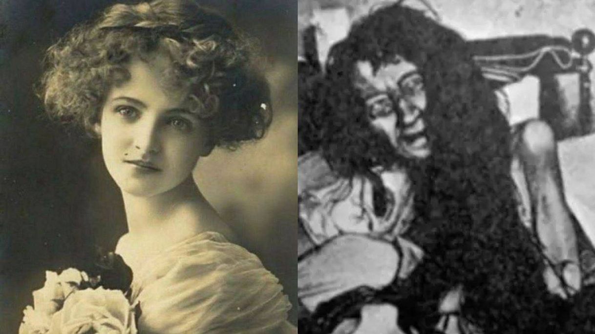 Social caso Blanche Monnier.