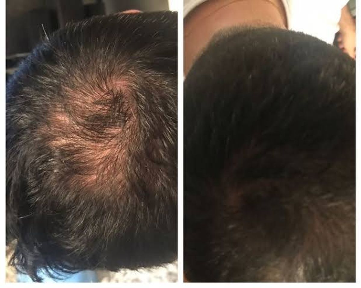 Fashion Trioxidil, um complexo nutritivo de tripla ação desenvolvido