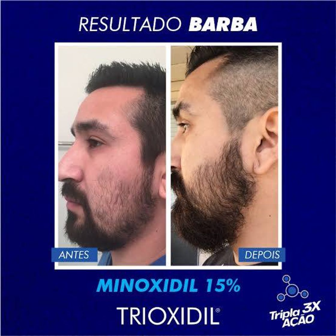 Moda Trioxidil, um complexo nutritivo de tripla ação desenvolvido