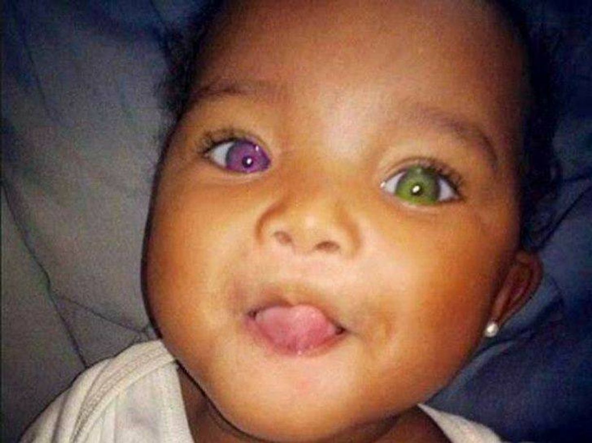 Social Olhos