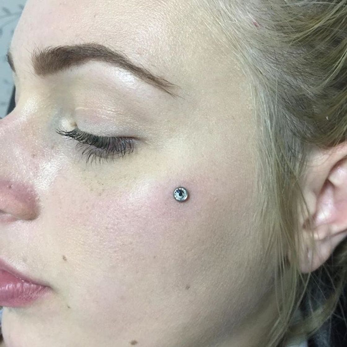 Social MICRODERMAL