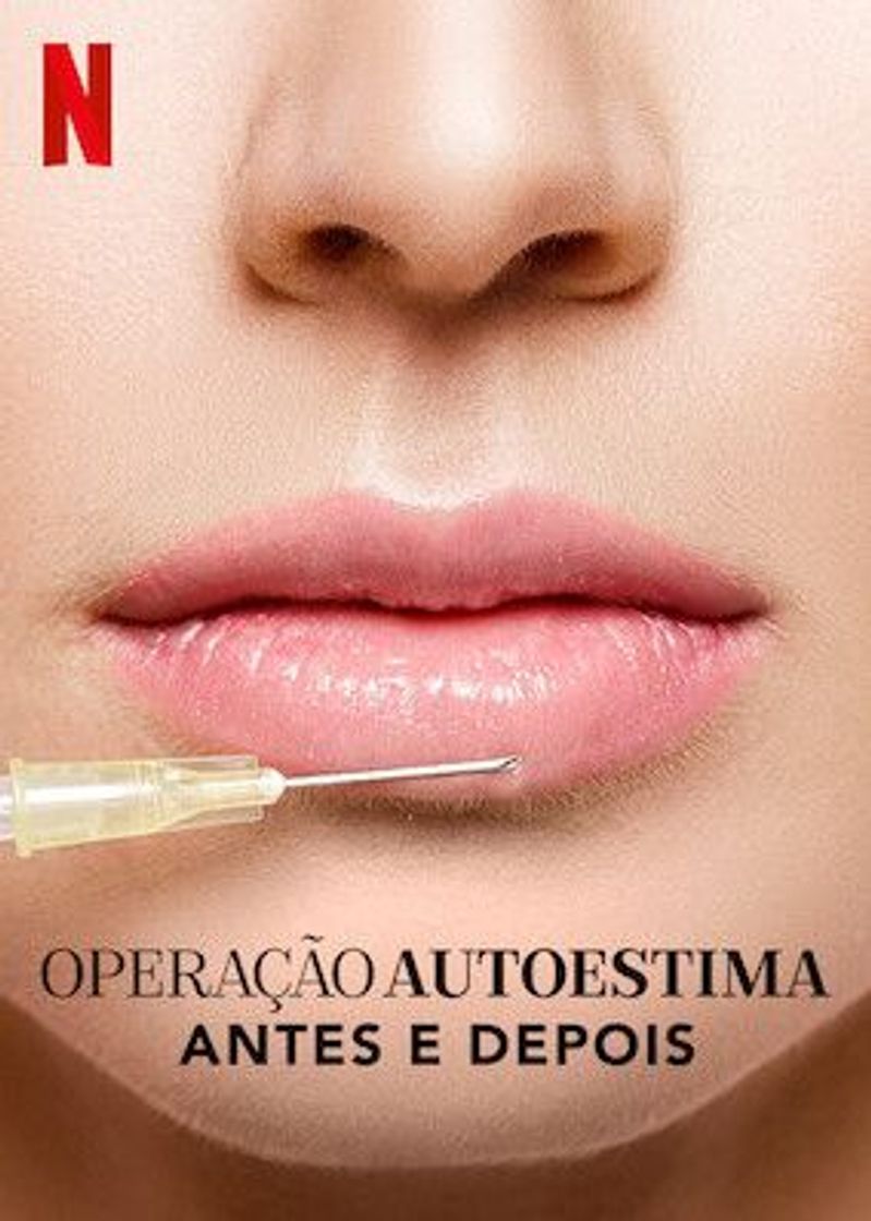 Serie Operação Autoestima: Antes e Depois