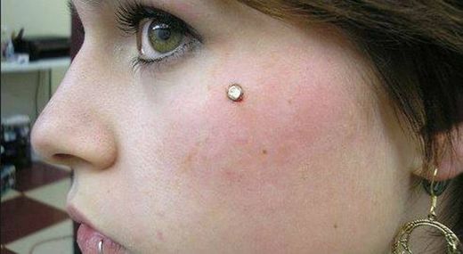 Piercing no rosto microdermal