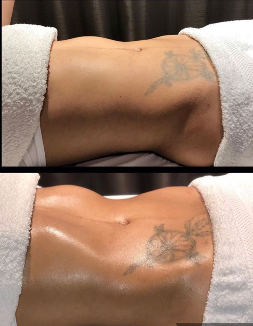 Social Resultado imediato drenagem 