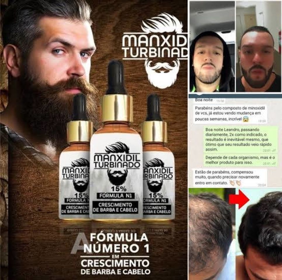 Productos Manxidil Turbinado 