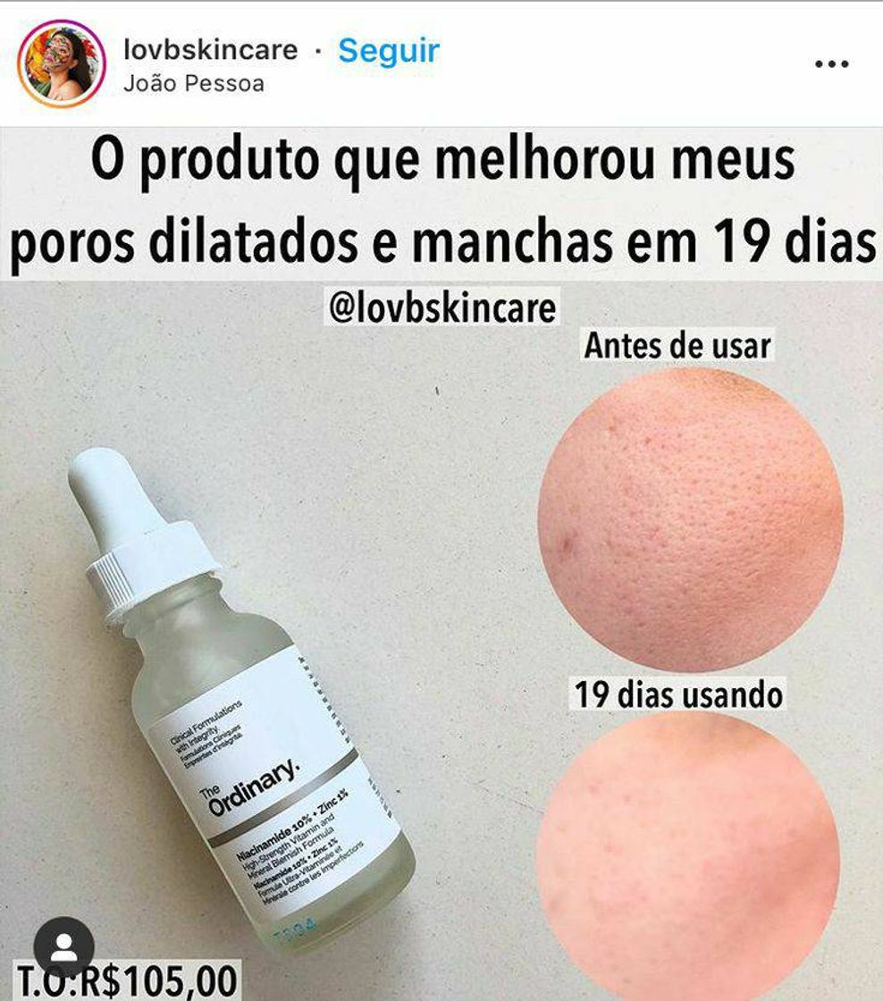 Fashion produto para poros dilatados