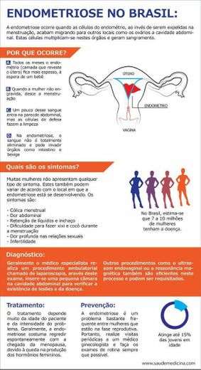 Endometriose se cuida