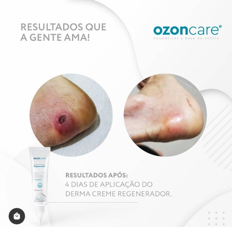 Moda Tratamento com Derma Creme Regenerador