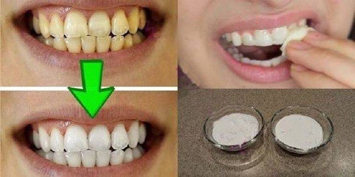 Social Como deixar os dentes brancos