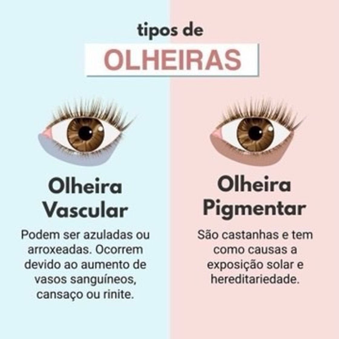 Moda Dica de hoje ! Suas olheiras são vascular ou pigmentadas ? 