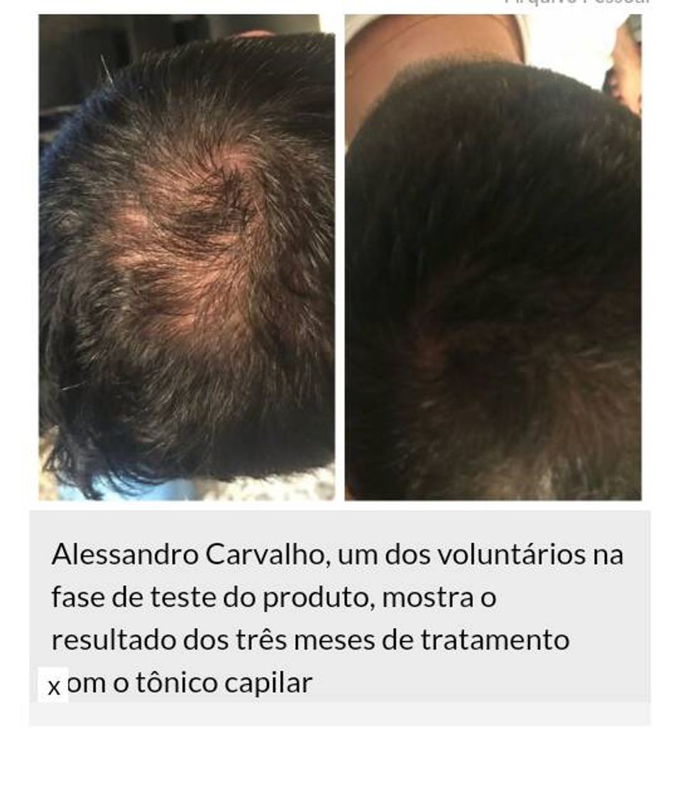 Products Produto para crescer cabelo