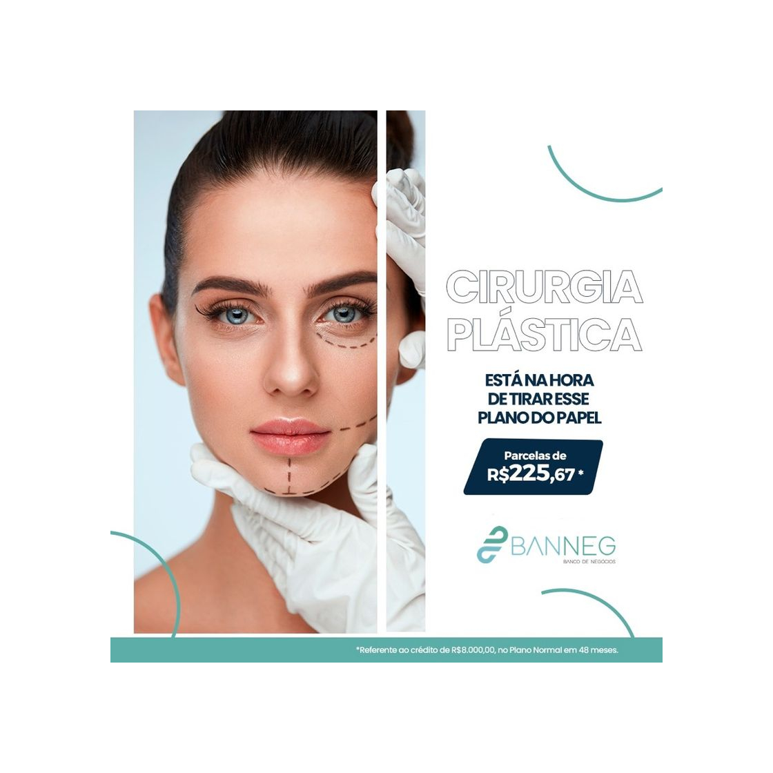 Social Consórcio para Cirurgia Estética