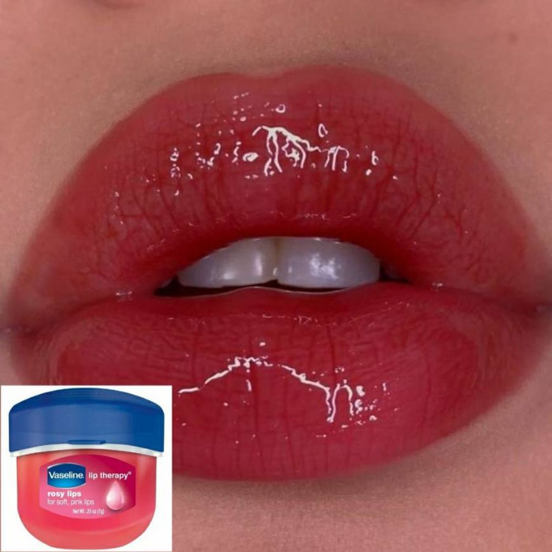 Social Lip balm