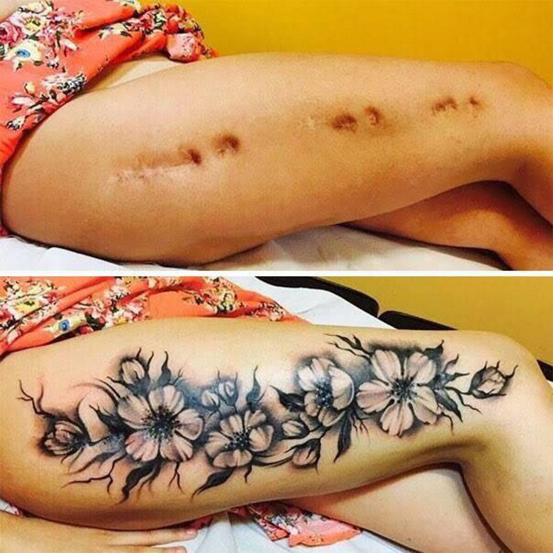 Moda Tatuagens para cobrir cicatrizes